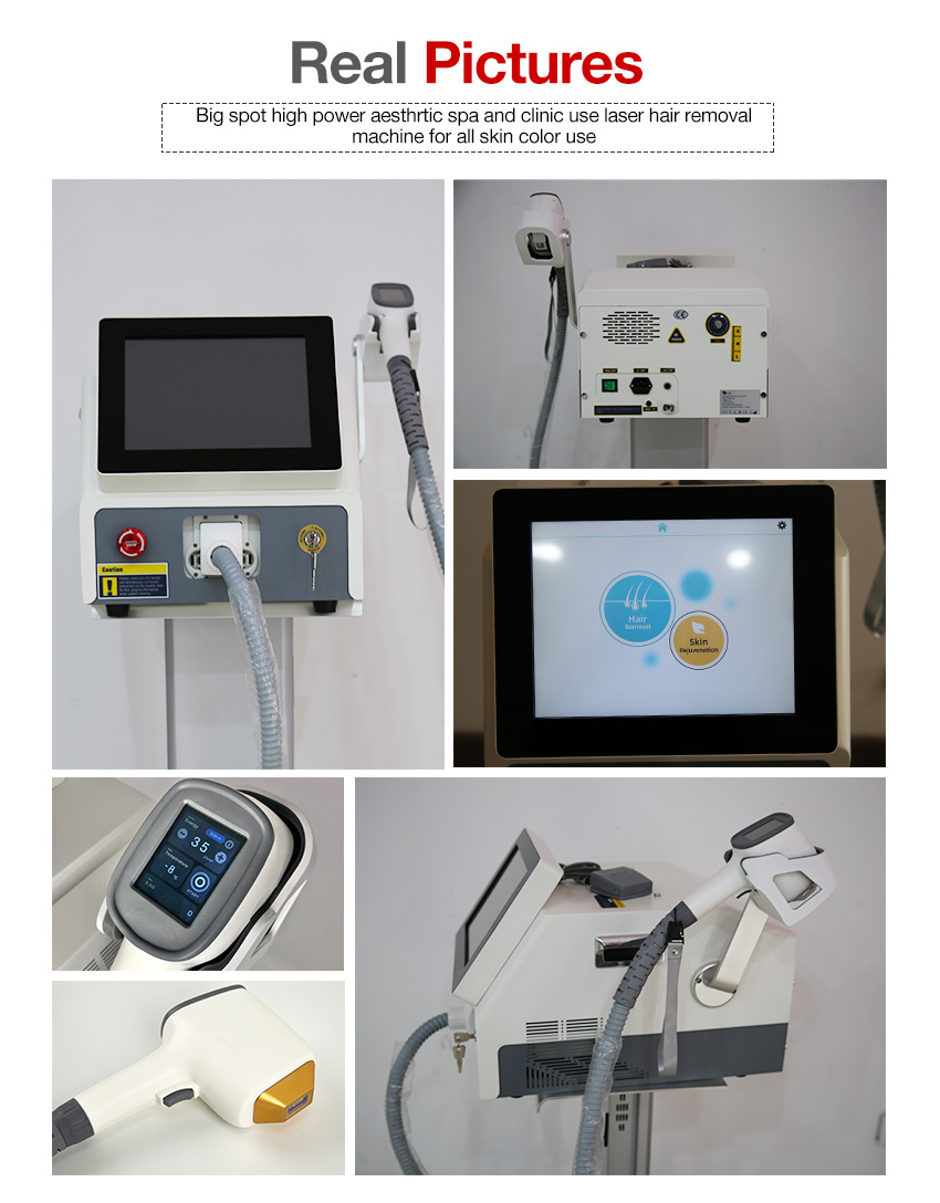 Best laser hair removal machine for bikini real photos