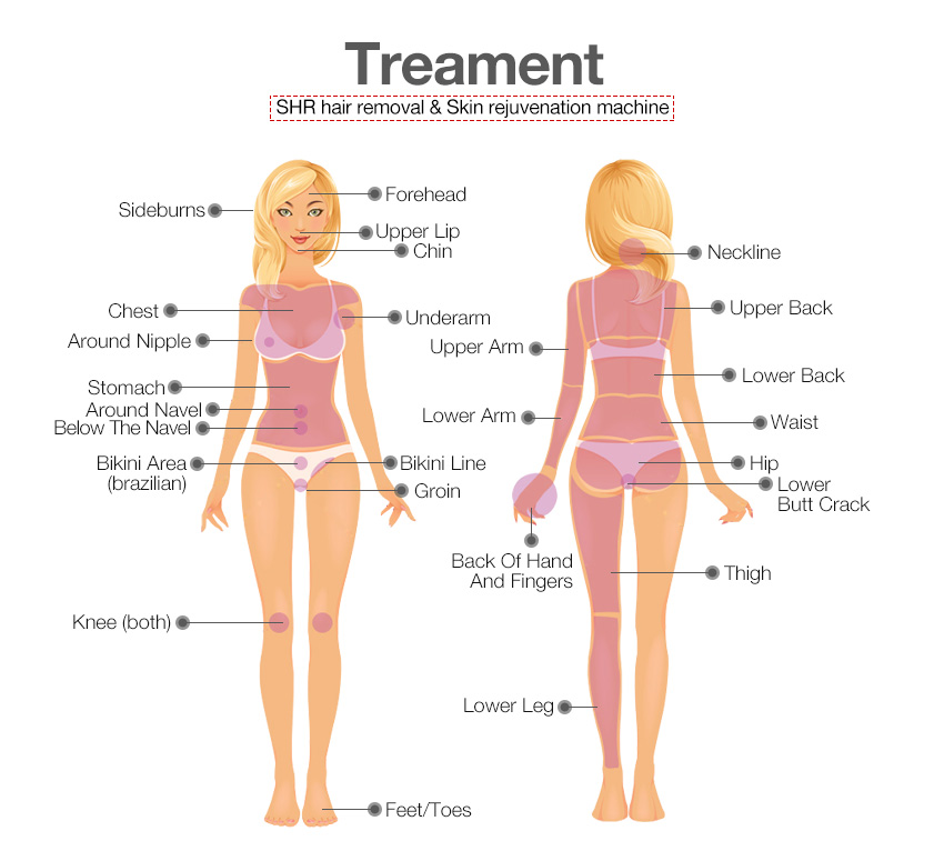 SHR hair removal machine Sellers