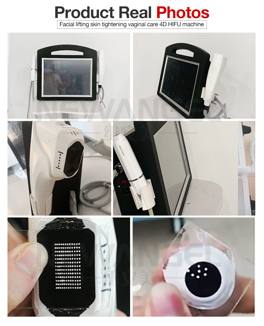 3d hifu machine face and vaginal real photos