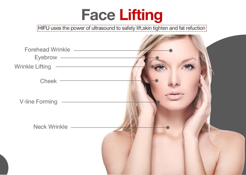 HIFU the most effective machines facial skin lifting