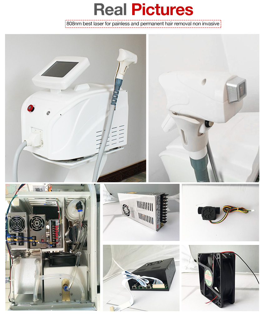 High Quality Commercial Laser Hair Removal Machine 6016