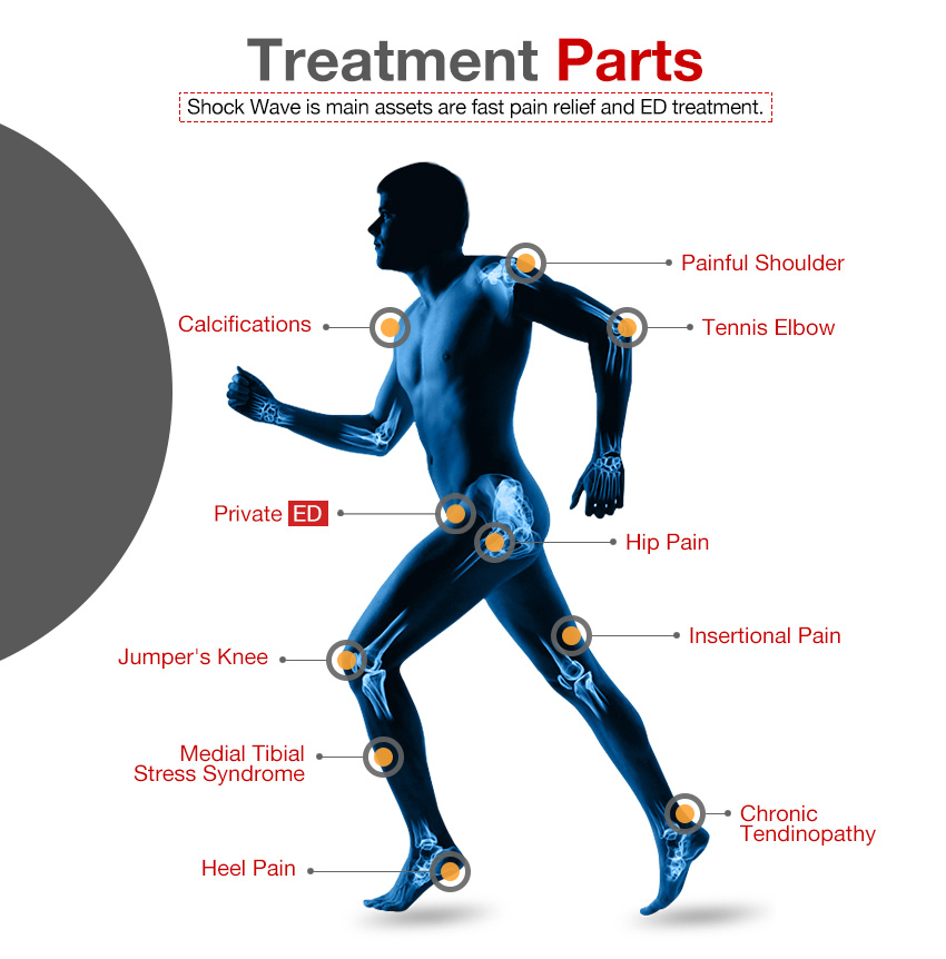 Low intensity shock wave therapy for pain relief