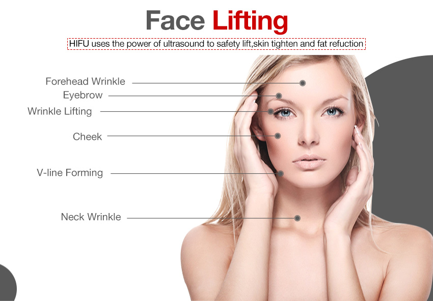 hifu non surgical face lift painless