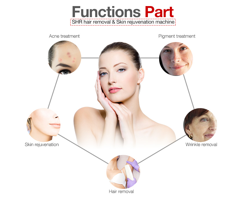 SHR hair removal machine treatment