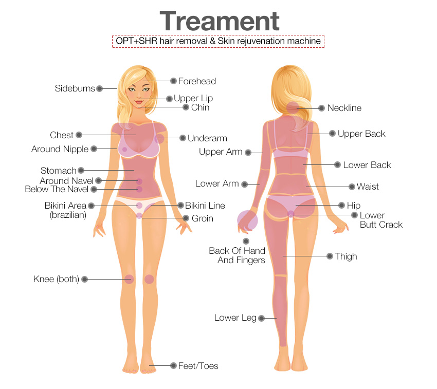 OPT SHR hair removal treatment
