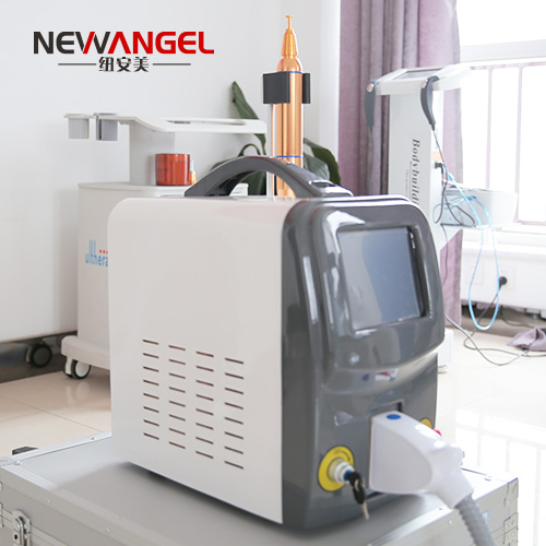 Picosecond laser machine tattoo removal