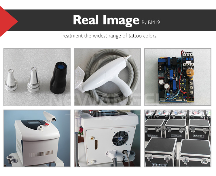 tattoo removal laser machine cost real photos