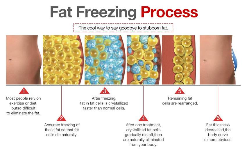 Portable cryolipolysis machine therapy