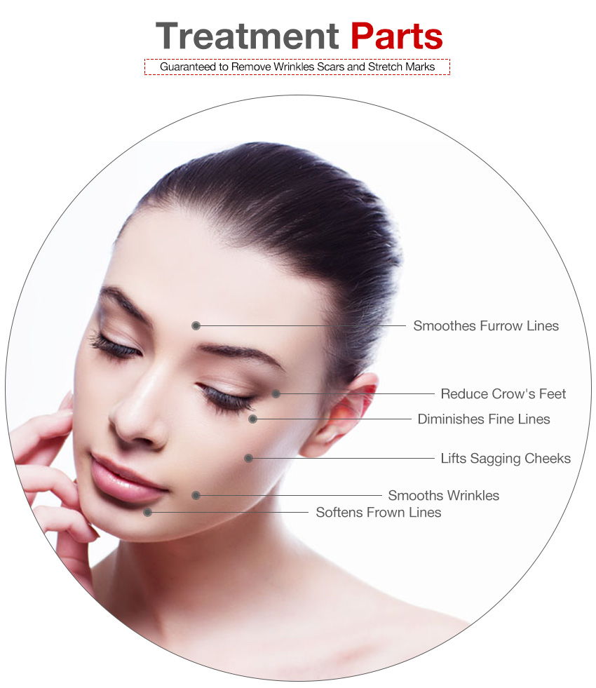Microneedling