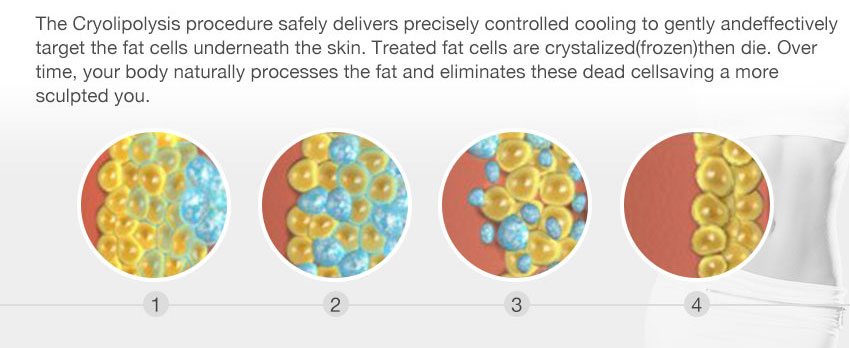 buy fat freezing machine theory