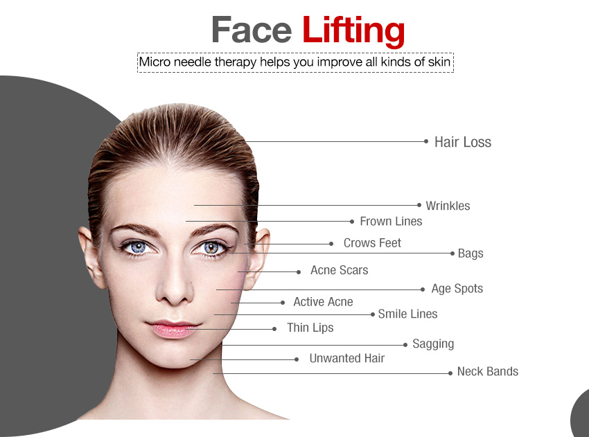 buy dermapen skin lifting