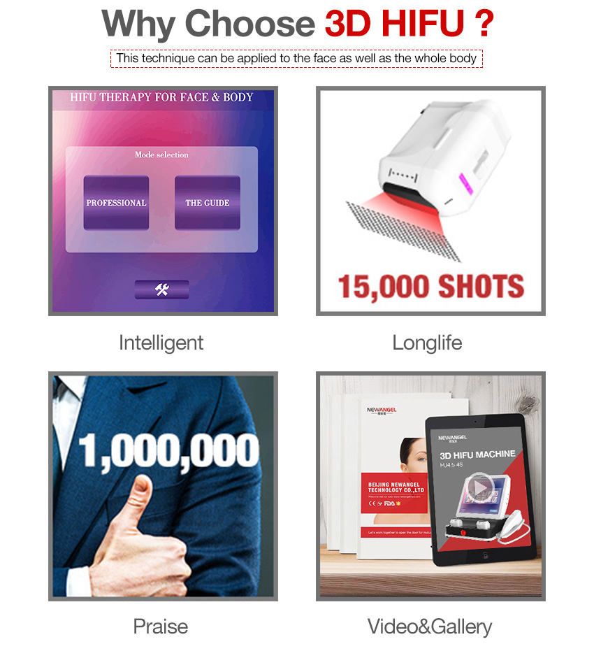 HIFU neck lift machine popular in the market