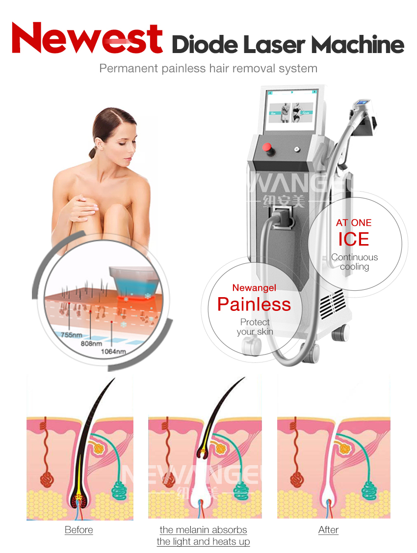 Best laser hair removal machine 2019