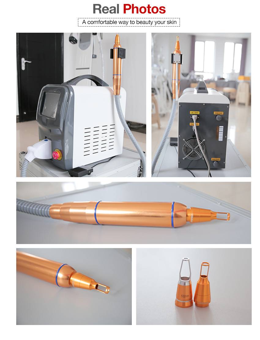  high power tattoo removal laser for sale