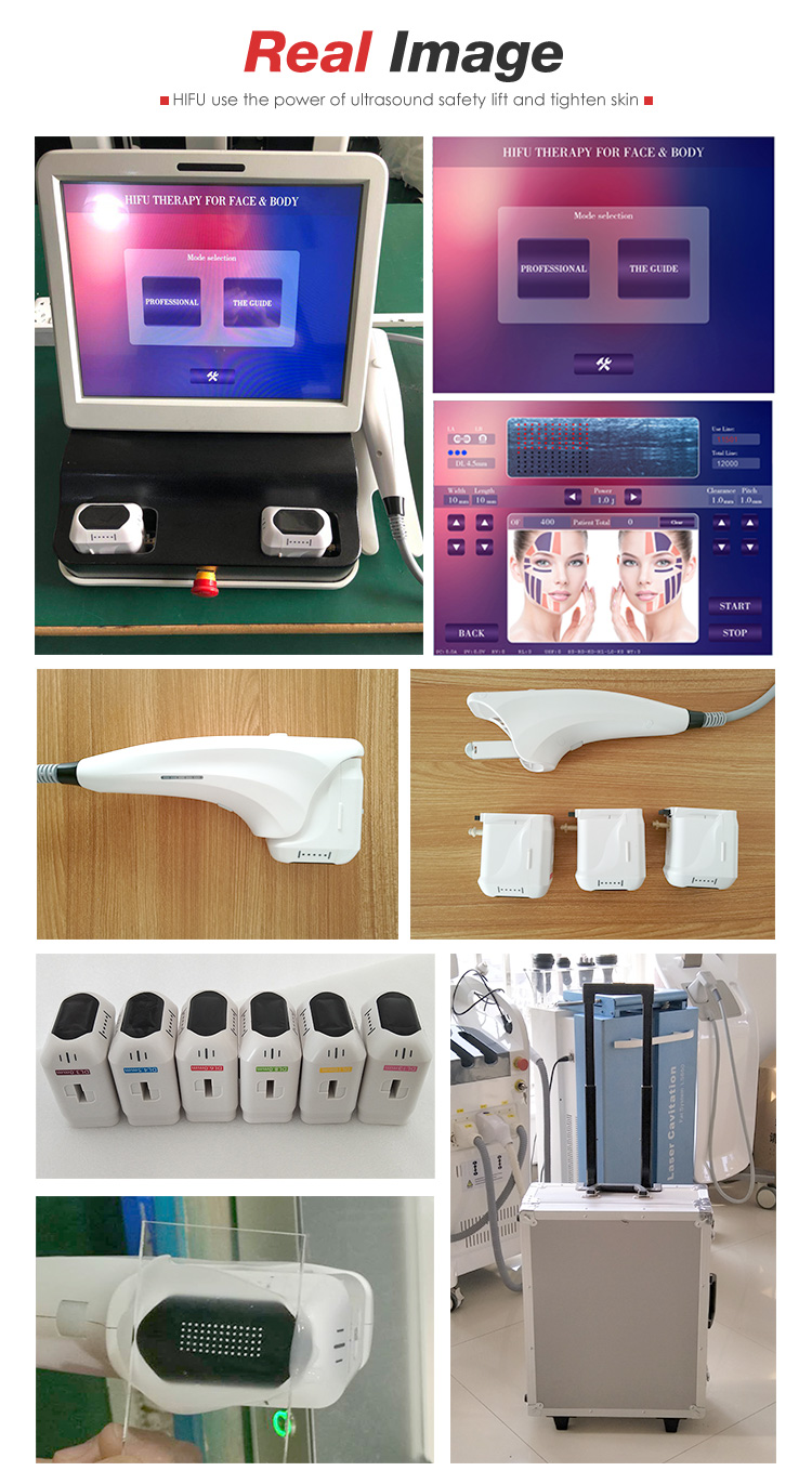 HIFU 3d machine factory sale with 3 years warranty