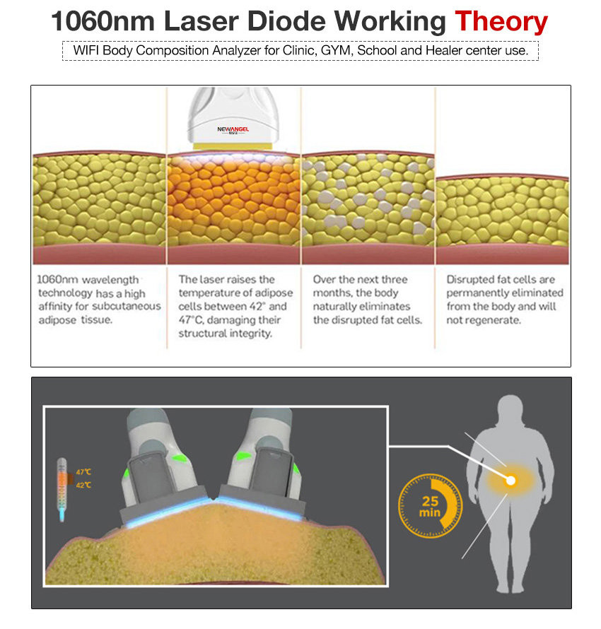 Laser diode 1060nm machine working theory