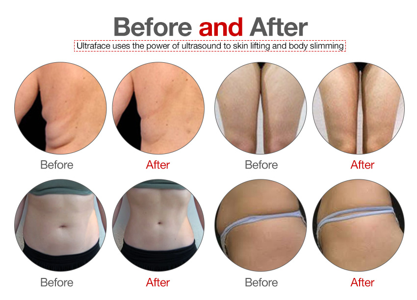 Cool slimming machine non-invasive lose weight CE certificate