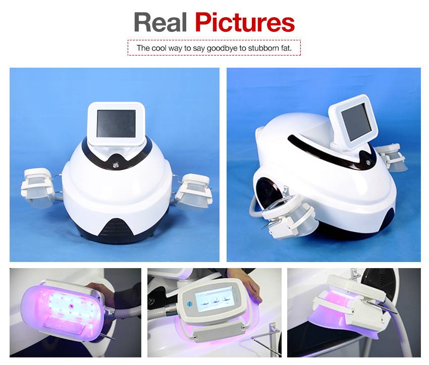 Portable cryolipolysis machine for fat loss