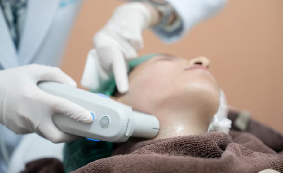 How Long Does It Take to Recover After HIFU? The Complete Aftercare Guide