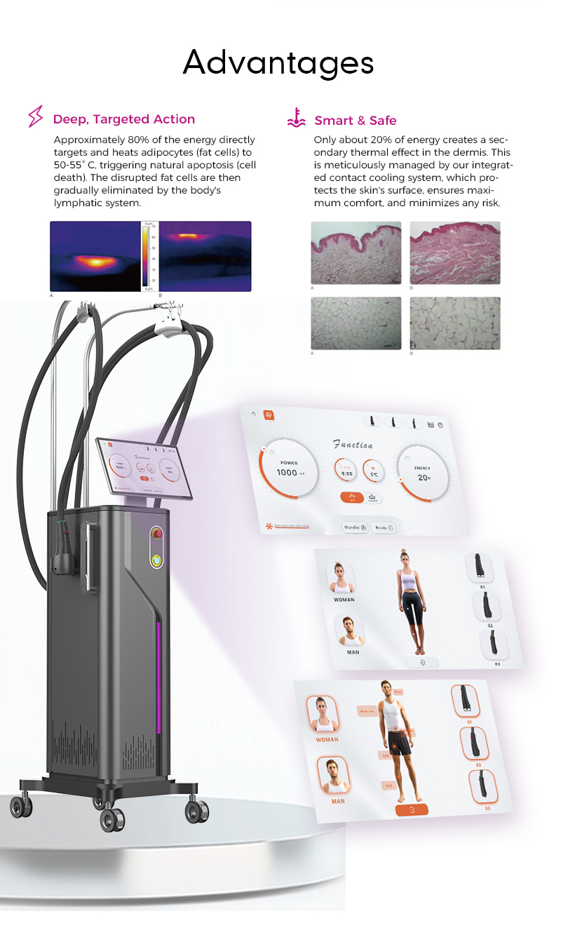Onda Coolwaves Microwave Body Contouring & Slimming Machine from