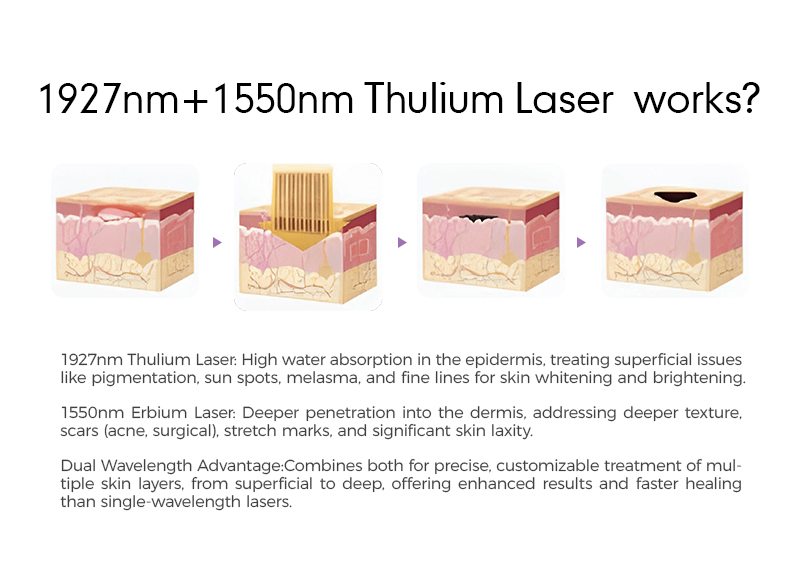 Professional 1927nm + 1550nm Non-Ablative Fractional Laser Machine